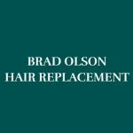 Brad Olson Hair Replacement Profile Picture