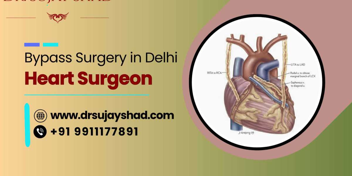FAQs on Coronary Artery Bypass Grafting (CABG) Surgery of Heart