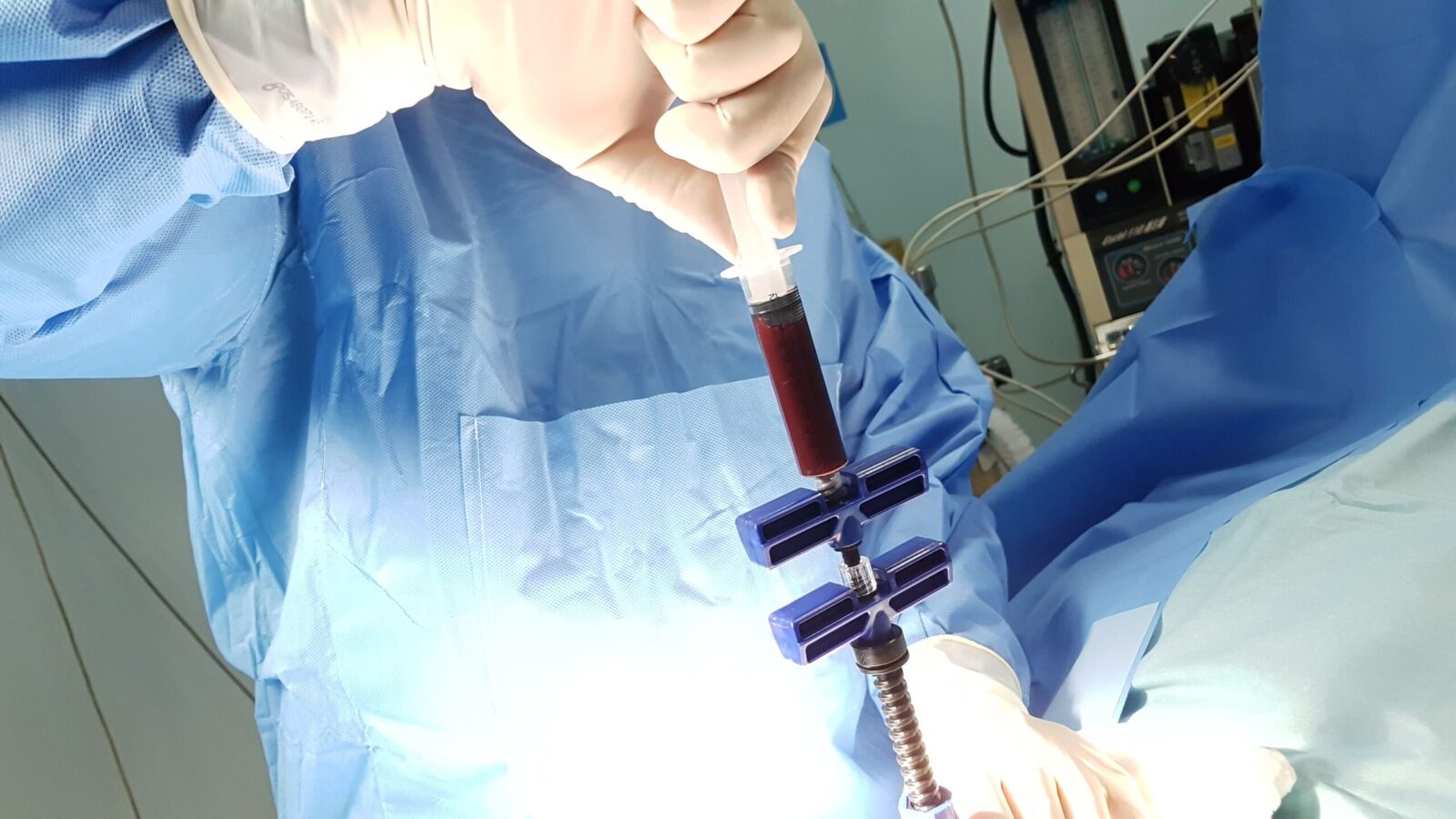 Regenerative Treatments for Chronic Pain Relief