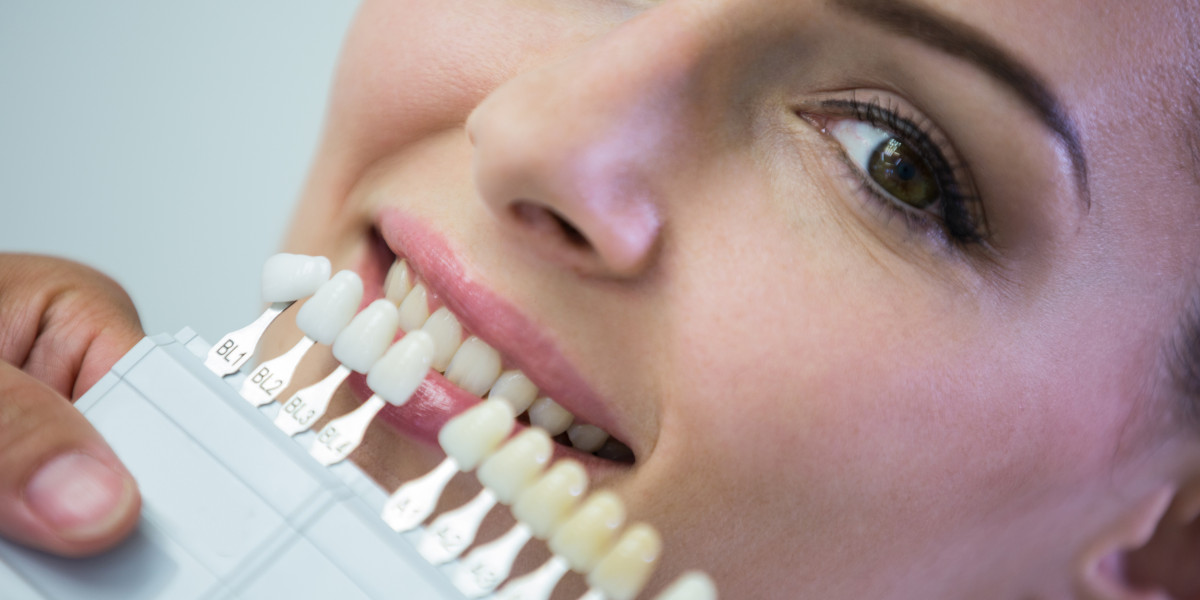How Many Teeth Do You Get on All-on-4 Dental Implants?