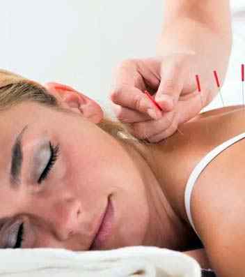 Acupuncture Mississauga – Aqua Clinic