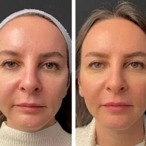 Advanced IVF and Fertility Care with Experienced IVF Specialists – Repur Tech