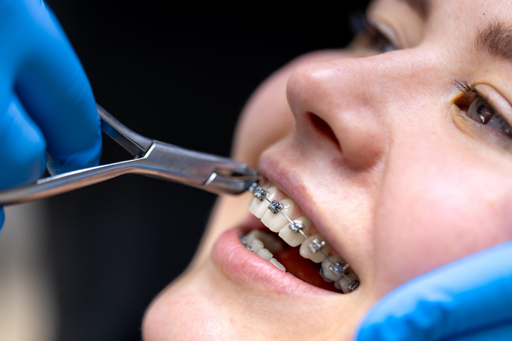 How Much Does Orthodontic Treatment Cost? What You Should Know – Trending Info Hub