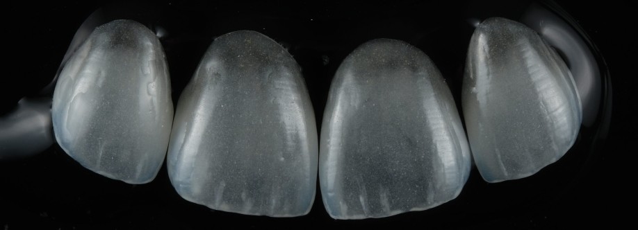 premium zahnimplantate Wien Cover Image