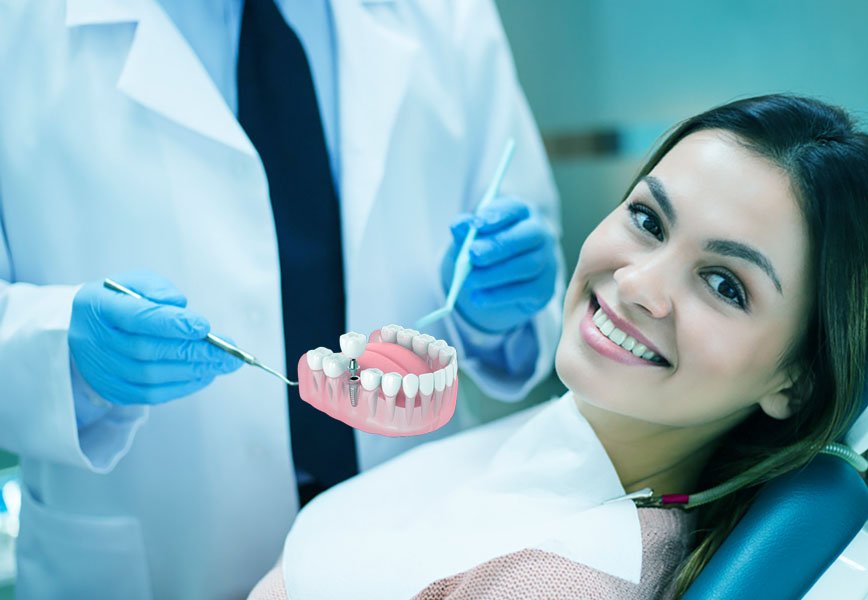 Dental Implants Cost in Perambur, Chennai | Jim's Dental