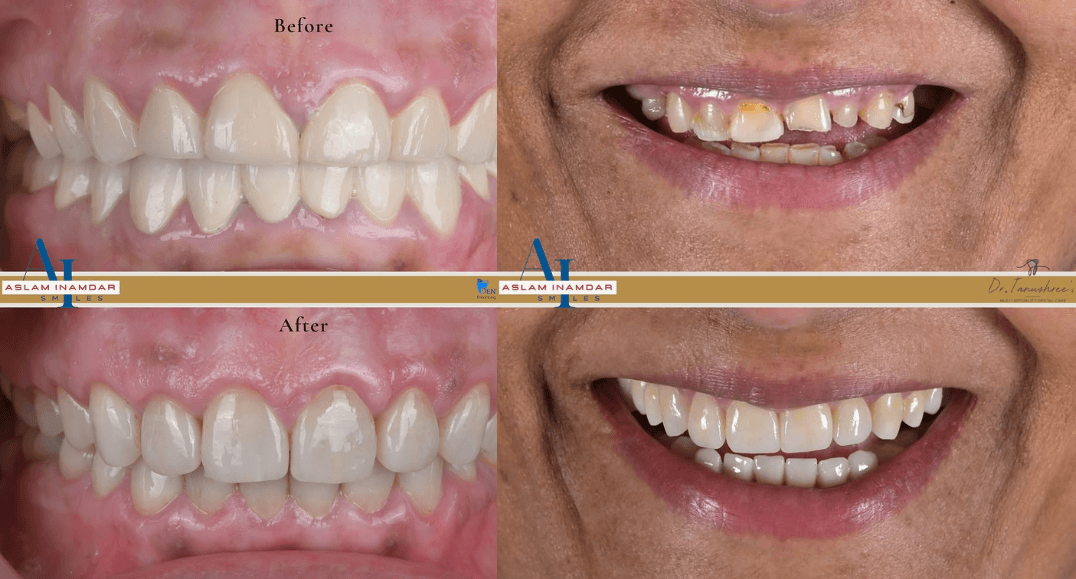 Dentists in Mumbai | Advanced & Painless Dental Care