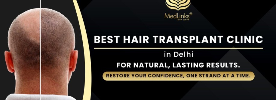 Hair Transplant Cover Image