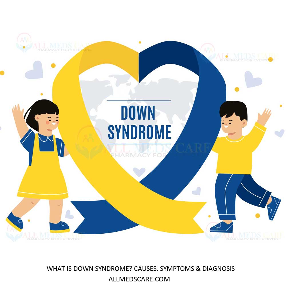 What Is Down Syndrome? Causes, Symptoms & Diagnosis - Allmedscare.com