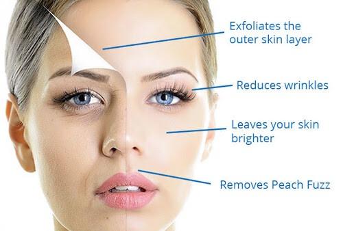 Dermarolling for Women Smooth Healthy Glowing Skin | BuzzingAbout