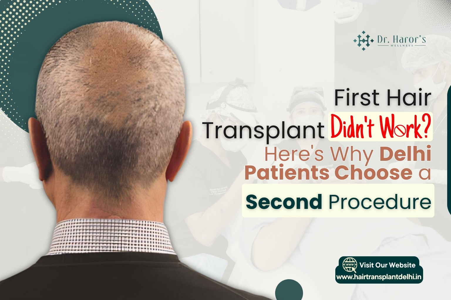 First Hair Transplant Didn’t Work? Here’s Why Delhi Patients Choose a Second Procedure – hairtransplantclinicinidia