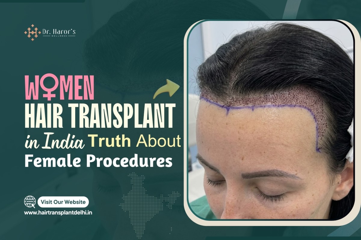 Women Hair Transplant in India: Truth About Female Procedures – hairtransplantclinicinidia